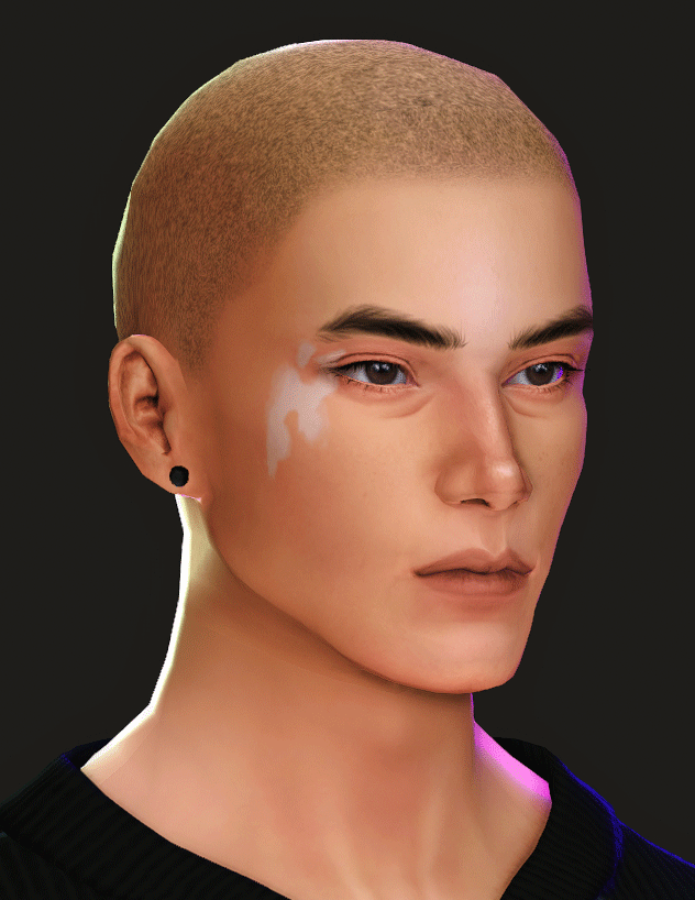Витилиго Vitiligo N2 для Sims 4